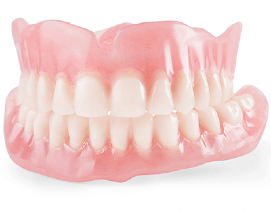 full-denture-coverage