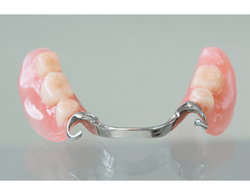 partial-denture-coverage