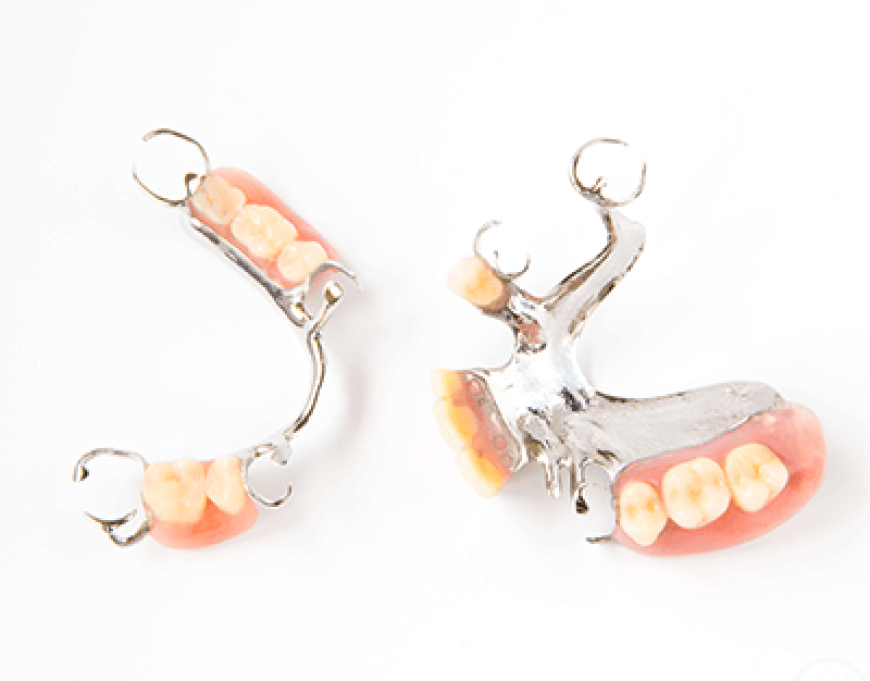 cast-partial-denture