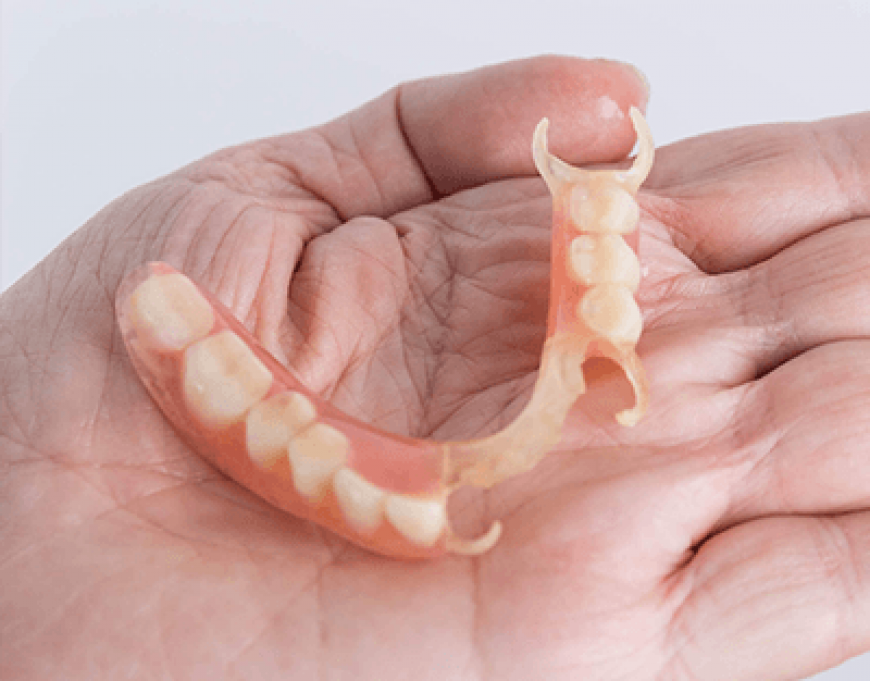 Valpast-Partial-Denture